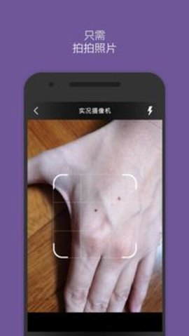 扫一扫识别皮肤病app手机版1